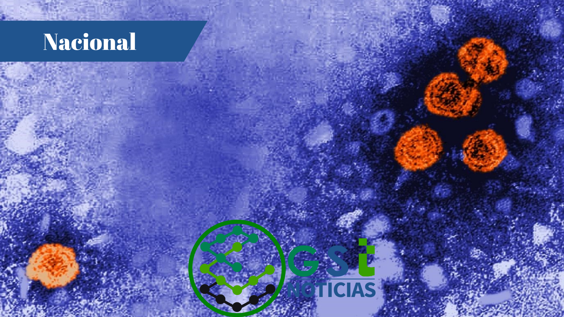 Con nuevo caso sospechoso de hepatitis aguda grave de origen desconocido, suman siete los pacientes atendidos en Jalisco - ZMG Noticias