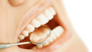 Problemas bucales, un “coco” para la Salud Pública - ZMG Noticias