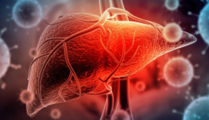 Suman 12 pacientes atendidos en Jalisco por sospecha de hepatitis aguda grave de origen desconocido - ZMG Noticias