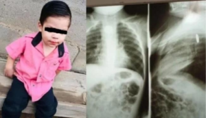 Bebé se traga una pila y se quema el esófago, lo reportan grave en el hospital de Sonora