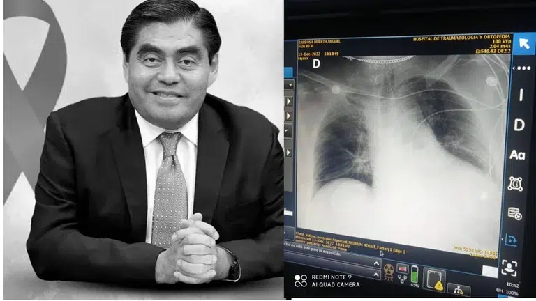 Presunta negligencia agravó salud de Miguel Barbosa en sus últimas horas