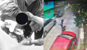 Niño de 5 años es atacado por pitbull en Morelos